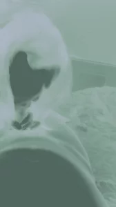 口活